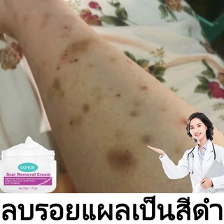 COD ของแท้ มลดรอยแผลเป็น แผลเป็น รแผลไฟไหม้ น้ำร้อนลว แผลผ่าตัด รอยแตกลายหลังครรภ์ แผลใหม่และแผลเป็นเก่า 50ml