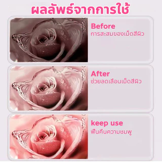 💕การดูแลสองเท่า💕 Aichun ครีมบำรุงหัวนมชมพู บำรุงจุดซ่อนเร้นให้ชมพู ขาวกระจ่างใส ลดเม็ดสีดำคล้ำ คืนความชมพูแบบสาววัยรุ่น