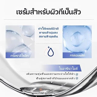 เอสเซนส์รักษาสิวไนอะซินาไมด์ กำจัดสิวได้อย่างมีประสิทธิภาพและรวดเร็ว บรรเทาอาการอักเสบ ลดรอยแผลเป็นจากสิว การควบคุมน้ำมัน การป้องกันการเกิดสิวซ้ำ Niacinamide Acne Treatment Serum Hiangel