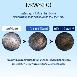LEWEDO Hair Growth Serum Roll-On 25ml หวีลูกกลิ้งน้ำมันหอมระเหย สารสกัดจากรากโสม ขิงสกัด หวีเซรั่ม