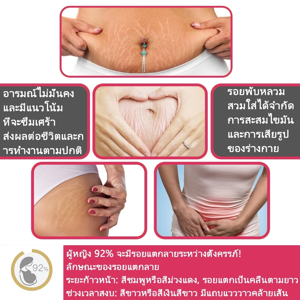 [รับประกันของแท้]Dr Jungle จังเกิลครีมทาท้องลาย 30ml  ครีมลดรอยแตกลายและ โลชั่นบำรุงผิวกาย Anti-Stretch Mark Cream ครีมทารอยแตกลาย มามาเบลล่า หน้าอกแตกลาย ท้องแตกลาย สำหรับคุณแม่. ราคา ถูกที่สุด ดีลบีเคเค แกลเลอรีภาพที่ 2