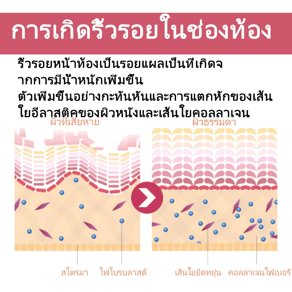 [รับประกันของแท้]Dr Jungle จังเกิลครีมทาท้องลาย 30ml  ครีมลดรอยแตกลายและ โลชั่นบำรุงผิวกาย Anti-Stretch Mark Cream ครีมทารอยแตกลาย มามาเบลล่า หน้าอกแตกลาย ท้องแตกลาย สำหรับคุณแม่. ราคา ถูกที่สุด ดีลบีเคเค แกลเลอรีภาพที่ 7