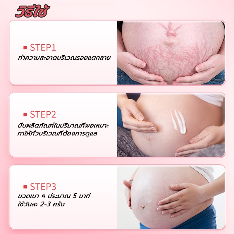[รับประกันของแท้]Dr Jungle จังเกิลครีมทาท้องลาย 30ml  ครีมลดรอยแตกลายและ โลชั่นบำรุงผิวกาย Anti-Stretch Mark Cream ครีมทารอยแตกลาย มามาเบลล่า หน้าอกแตกลาย ท้องแตกลาย สำหรับคุณแม่. ราคา ถูกที่สุด ดีลบีเคเค แกลเลอรีภาพที่ 6