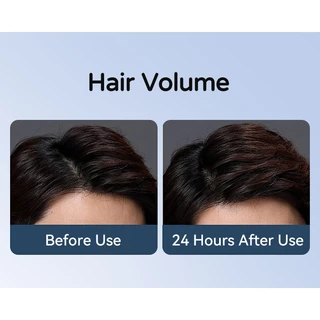 ตัวอย่างแชมพู Rocean 5g 4-in-1 Anti-Dandruff Oil Control Volumizing | Scalp Care ป้องกันผมร่วง