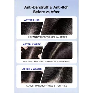 ตัวอย่างแชมพู Rocean 5g 4-in-1 Anti-Dandruff Oil Control Volumizing | Scalp Care ป้องกันผมร่วง