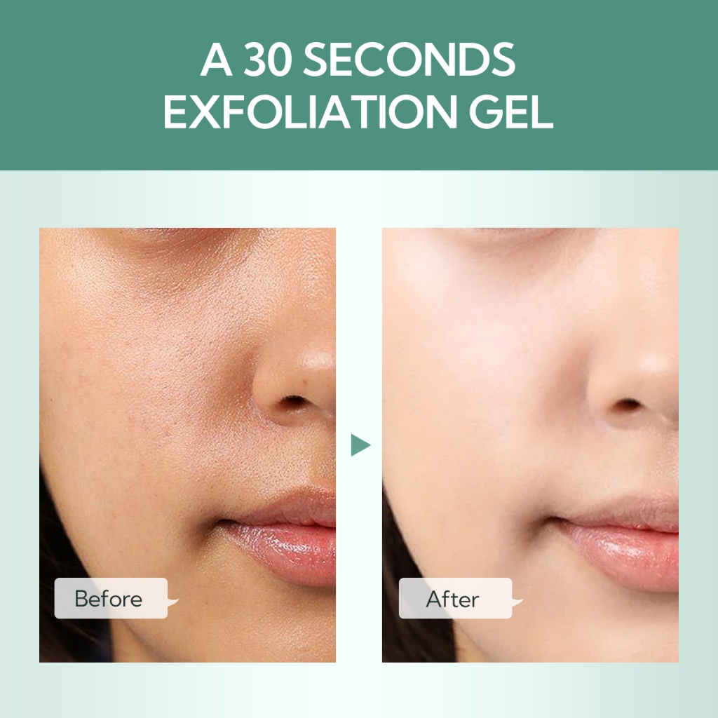 SHE Eureka เจลขัดผิวสมุนไพร 50g Exfoliating Gel รูปที่ 4