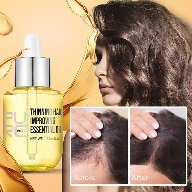 PURC Ginger Hair Growth Serum Anti Hair Loss Scalp Treatment สําหรับผมบาง Regrowth น้ํามันบํารุงรากล