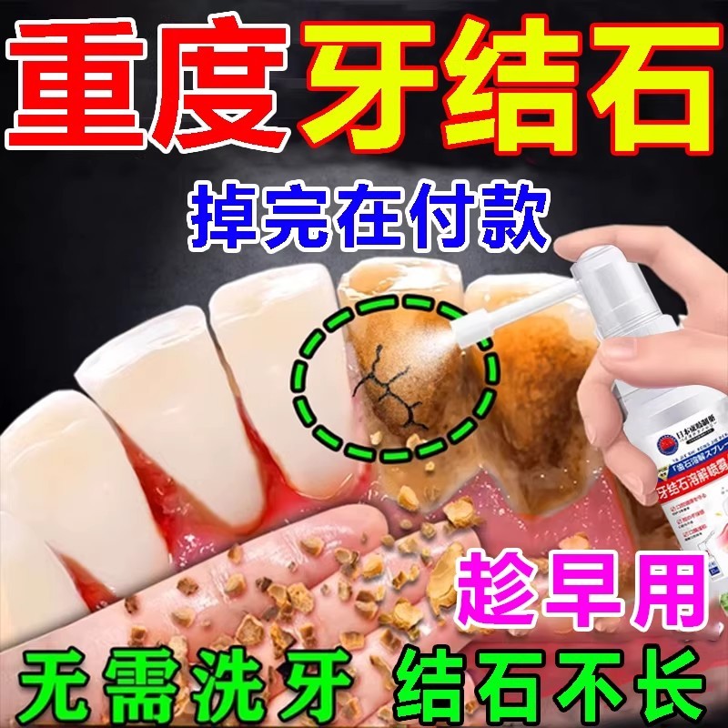 Japan Toki Gentle Oral Care Spray | ใช้ทุกวันช่วยทําความสะอาดช่องปากรักษาสุขภาพฟัน | สดชื่น อ่อนใจไม่หาย