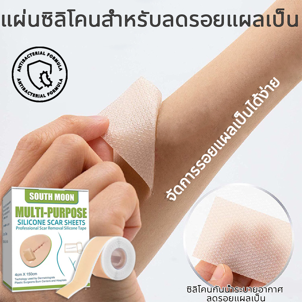 พร้อมส่ง South Moon แผ่นแปะแผลเป็น แผ่นซิลิโคนรักษารอยแผลเป็น มีประสิทธิภาพในการกำจัดรอยแผลเป็นทั้งใหม่และเก่า ช่วยให้รอยจางลง ทำให้ผิวเรียบเนียนขึ้น ขนาด 4cm*150cm