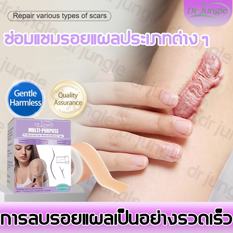 🔥ของแท้🔥 Dr.Jungle แผ่นแปะลดรอยแผลเป็น แผ่นแปะแผลเป็น ซิลิโคนลดรอยแผลเป็น เหมาะสำหรับรอยแผลเป็นใหม่และเก่า ลดรอยแผลเป็น คืนผิวเนียนใส เหมาะสำหรับแผลนูน กันน้ำ ขนาด 4*150cm