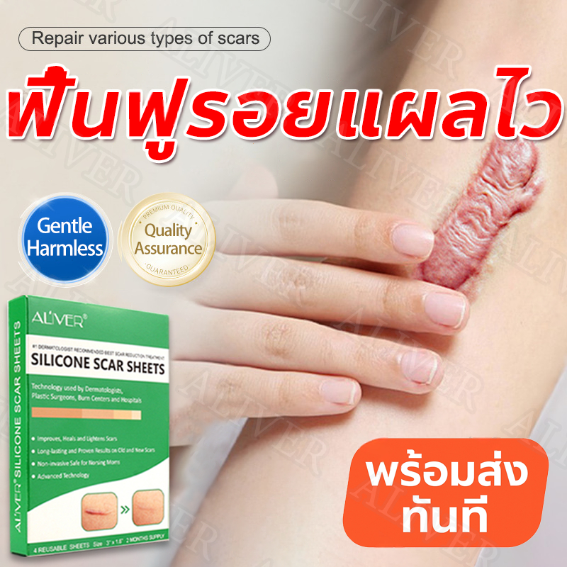 ALIVER แผ่นแปะลดรอยแผลอ่อนโยน ฟื้นผิวเรียบเนียน เหมาะสําหรับรอยผ่าตัด สิว ไฟไหม้ ระบายอากาศดี โปร่งใส เหมาะกับทุกผิว