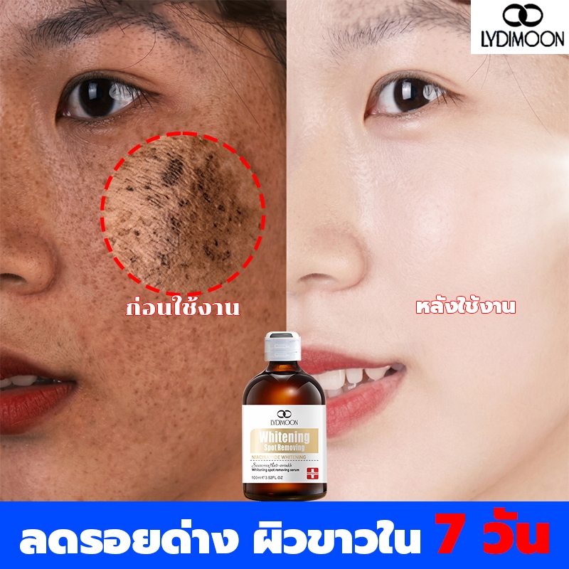 เซรั่มลดฝ้า เซรั่มลดฝ้า ไวท์เทนนิ่งผิวหน้ ลบเมลานิน กำจัดฝ้า จุดด่างดำ กระ กระจ่างใสผิว ซ่อมแซมดูแลให้ผิวนุ่ม 100ml