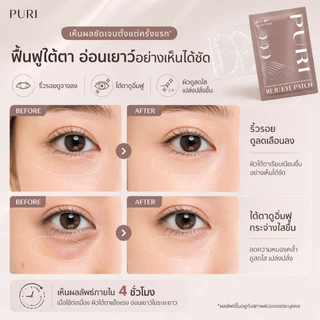Puri มาส์กตา มาส์กเข็ม Microneedle 3000 เข็ม ลดริ้วรอยใต้ตา ลดถุงใต้ตา ยกกระชับ หน้าผาก ร่องแก้ม นวัตกรรมเกาหลี | Reju Eye Patch Size S 3 ชิ้น [ของแท้ 100%]