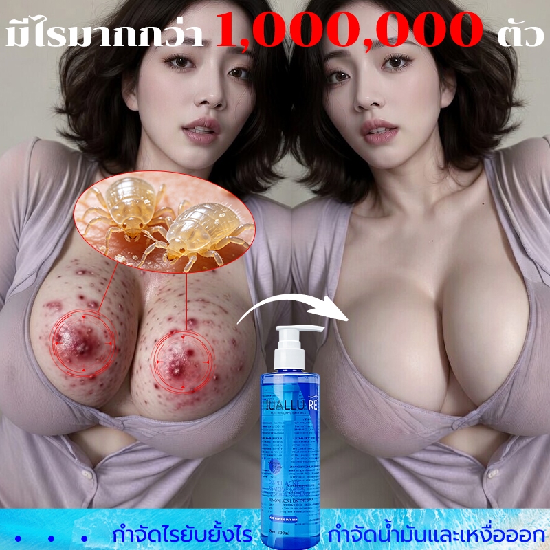 เจลอาบน้ำลดสิวกาย เจลอาบน้ำลดสิว ครีมอาบน้ำลดสิว ต่อต้านเชื้อราแก้คัน มีส่วนช่วยลดสิวที่หลัง และลำตัว กลิ่นกาย300ml