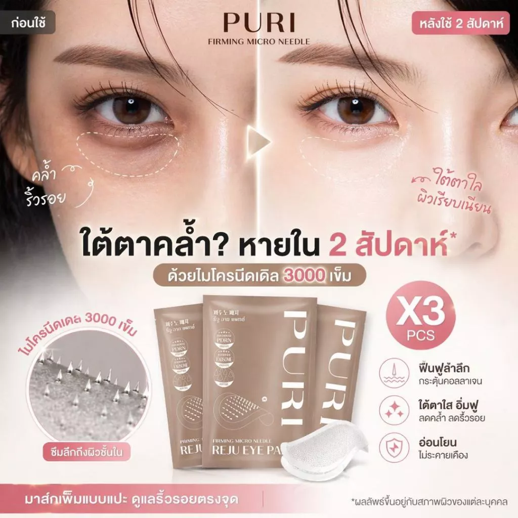 Puri มาส์กตา มาส์กเข็ม Microneedle 3000 เข็ม ลดริ้วรอยใต้ตา ลดถุงใต้ตา ยกกระชับ หน้าผาก ร่องแก้ม นวัตกรรมเกาหลี | Reju Eye Patch Size S 3 ชิ้น [ของแท้ 100%]