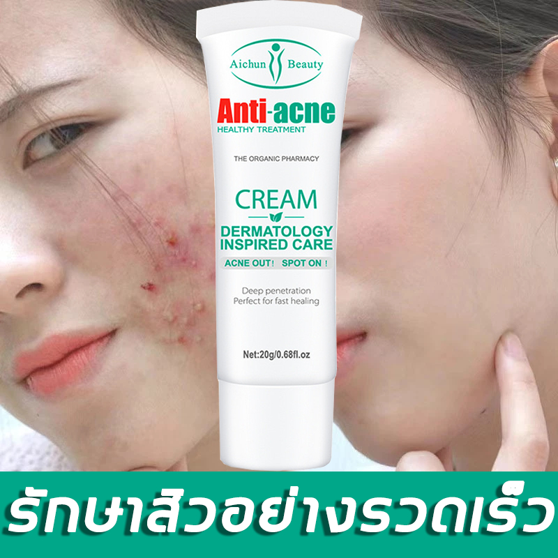 🔥ส่งจากกรุงเทพ🔥 ครีมทาสิว เจลแต้มสิว ลดรอยสิว ลดการเกิดสิว ลดการอักเสบ สมุนไพรจีนจากธรรมชาติ ไม่อุดตันรูขุมขน ปรับสมดุลความมัน ควบคุมความมัน เนื้อบางเบา เติมความชุ่มชื้น ผิวแพ้ง่าย ใช้ได้ ขนาด 20 กรัม