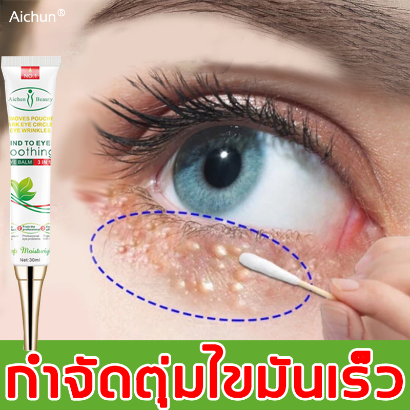 ของแท้ Ai Chun ครีมตาตุ่มไขมัน ออกแบบมาเพื่อลดปัญหาตุ่มไขมัน มีส่วนผสมที่มีประสิทธิภาพ ช่วยลดการเกิดตุ่มไขมันใต้ตา บำรุงผิวรอบดวงตา ลดเลือนริ้วรอย คืนความกระจ่างใส และกระชับผิวให้ดูอ่อนเยาว์ ชุ่มชื้นยาวนาน เหมาะสำหรับการดูแลผิวรอบดวงตาของคุณ30ml – โปรปัง