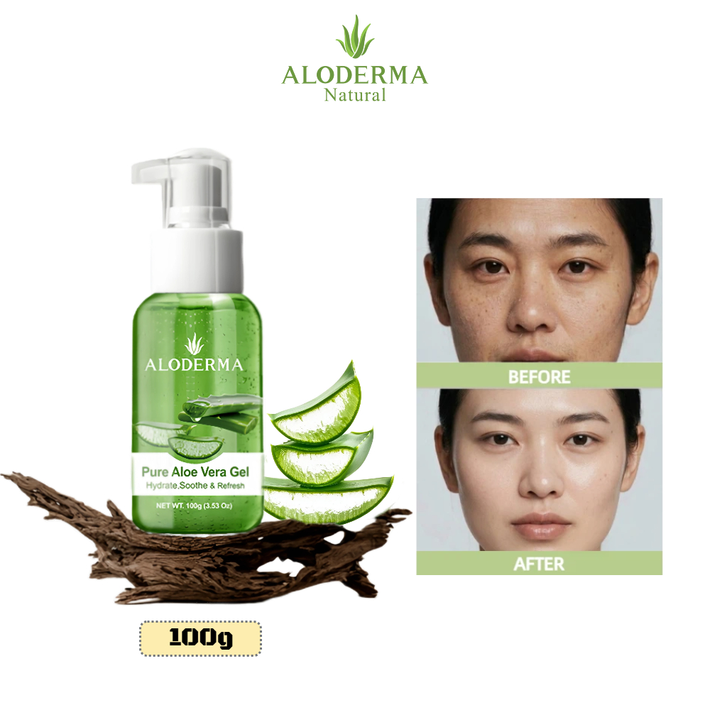 ALODERMA เจลว่านหางจระเข้ 100g 【ของแท้ 100%】 ท่องเที่ยว ชุ่มชื้น ซ่อมแซมผิว หลังแดดใช้