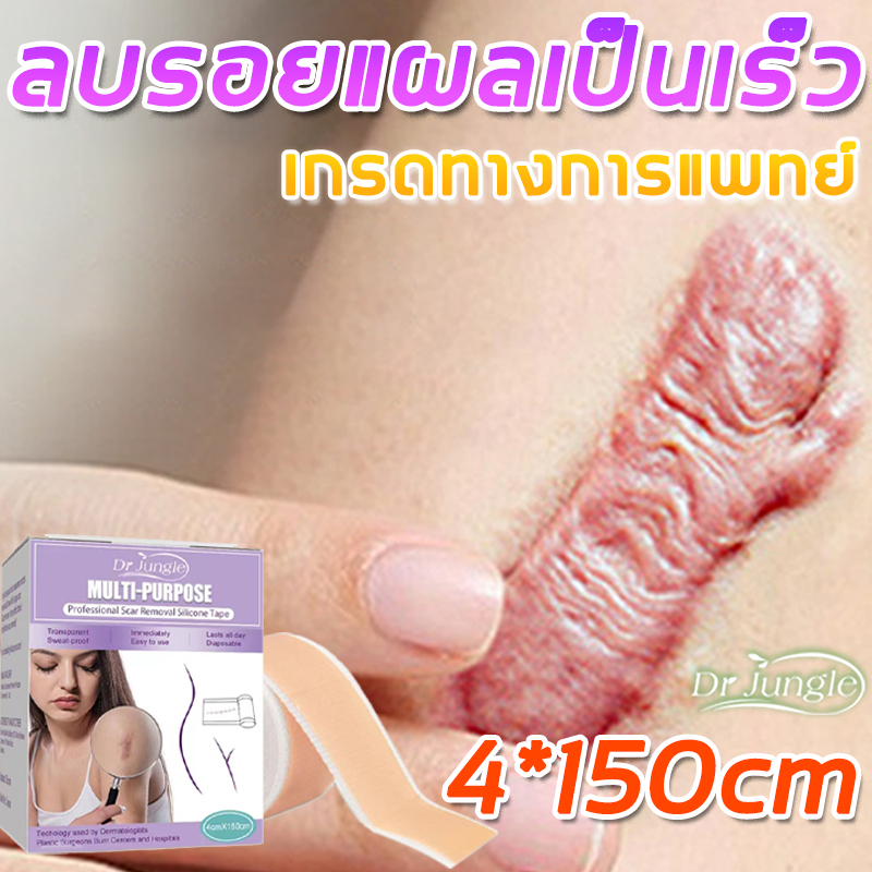 🔥ของแท้🔥Dr Jungle แผ่นแปะลบรอยแผลเป็น แผ่นแปะซิลิโคนกำจัดรอยแผลเป็น แผลเป็น กำจัดรอยแผลเป็น รอยแผลเป็น ขนาด 4*150cm สำหรับแผลผ่าตัด รอยแผลเป็นทุกชนิด เผาแผลเป็นแผ่นซ่อมแซมผิวกําจัดรอยแผลเป็นแพทช์บําบัด