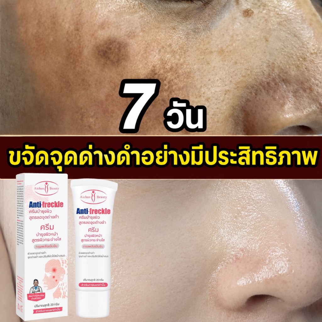 100% ของแท้ 💖 Aichun ครีมลดฝ้า ลดกระ ลดจุดด่างดำ ลดรอยสิว ช่วยให้ผิวชุ่มชื้น ฟื้นฟูผิว เติมน้ำให้ผิว กระจ่างใส ดูเรียบเนียนขึ้น ลดความหมองคล้ำบนใบหน้า