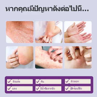 NEW ARRIVE! Kreain Nature Skin Soothing Cream สูตรเย็นแรง! ครีมแก้ผื่นคันผิวอักเสบเร่งด่วน ลดอาการคันทันที+ลดการอักเสบเห็นผลชัดเ