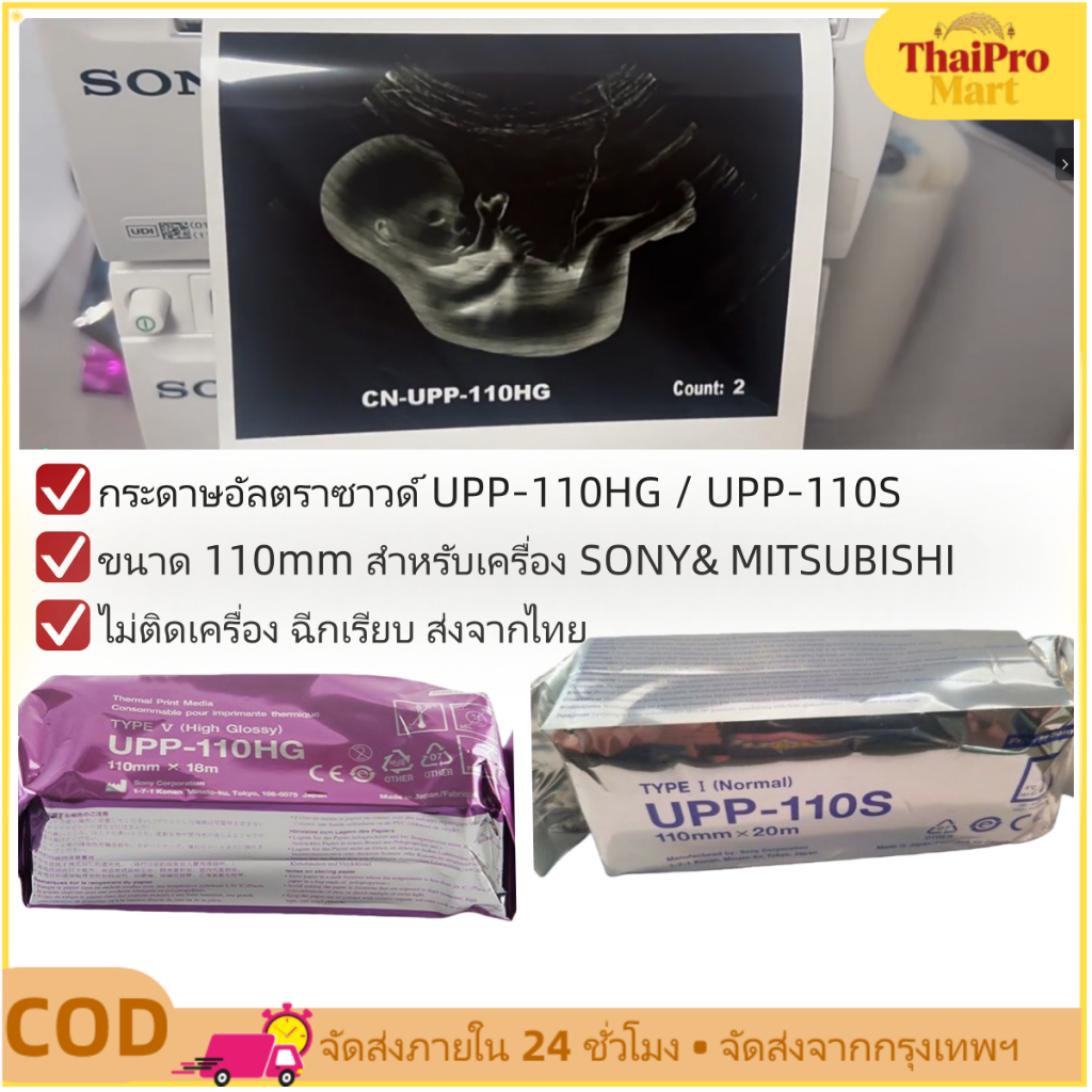 กระดาษอัลตราซาวด์ UPP-110HG 110mm สำหรับ SONY UP-895 UP-X898MD MITSUBISHI เครื่องพิมพ์ภาพ USG