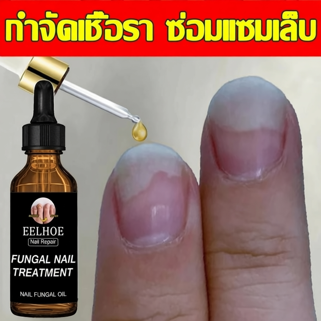 nail repair serum รักษาโรคเชื้อราที่เล็บ ซ่อมเล็บฉีก