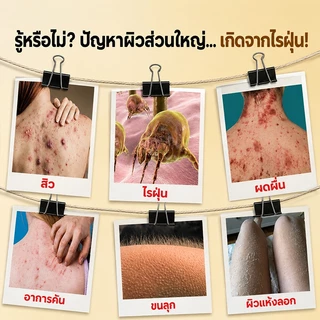 เจลอาบน้ำป้องกันไรฝุ่นกำมะถัน ครีมอาบน้ำกำจัดไร ครีมอาบน้ําลดสิว 500ml กำจัดไรลดสิว แก้คัน ลดการสะสมของแบคทีเรี