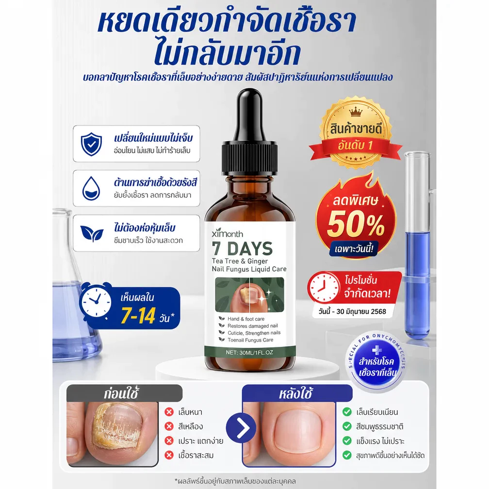 ✨ฆ่าเชื้อราได้ผลใน 7 วัน⏱️น้ำยารักษาเชื้อราที่เล็บ น้ำยาซ่อมแซมเล็บเหลือง น้ำยารักษาเล็บ กำจัดเสีย ซ่อมแซมแตก ฟื้นฟูเนื้อใหม่แบบเห็นผลชัดเจน