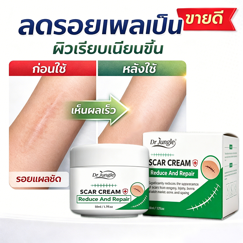 ⚡จัดส่งรวดเร็ว⚡Drjungle ครีมแผลเป็น ครีมลบรอยแผลเป็น ครีมซ่อมแซมรอยแผลเป็น แผลไฟไหม้ น้ําร้อนลวก รอยแผลเป็นหลังคลอด จางและลบรอยแผลเป็นทุกชนิด อ่อนโยนไม่ระคายเคือง ขนาด 50 กรัม