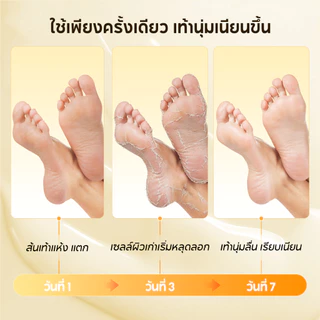 LANBENA Foot Peel Mask 40g/Pair มาส์กลอกเปลือกเท้า กำจัดเซลล์ผิวเก่า หลุดลอกง่าย ให้ผิวเนียนขาว หลายสูตร มาส์กเท้า