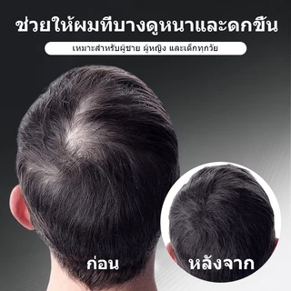 Sevich สเปรย์คอนซีลเลอร์ ป้องกันผมร่วง แบบหนา กันน้ํา สีดํา 120 มล.