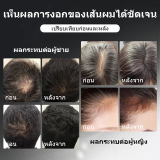 Sevich สเปรย์คอนซีลเลอร์ ป้องกันผมร่วง แบบหนา กันน้ํา สีดํา 120 มล.