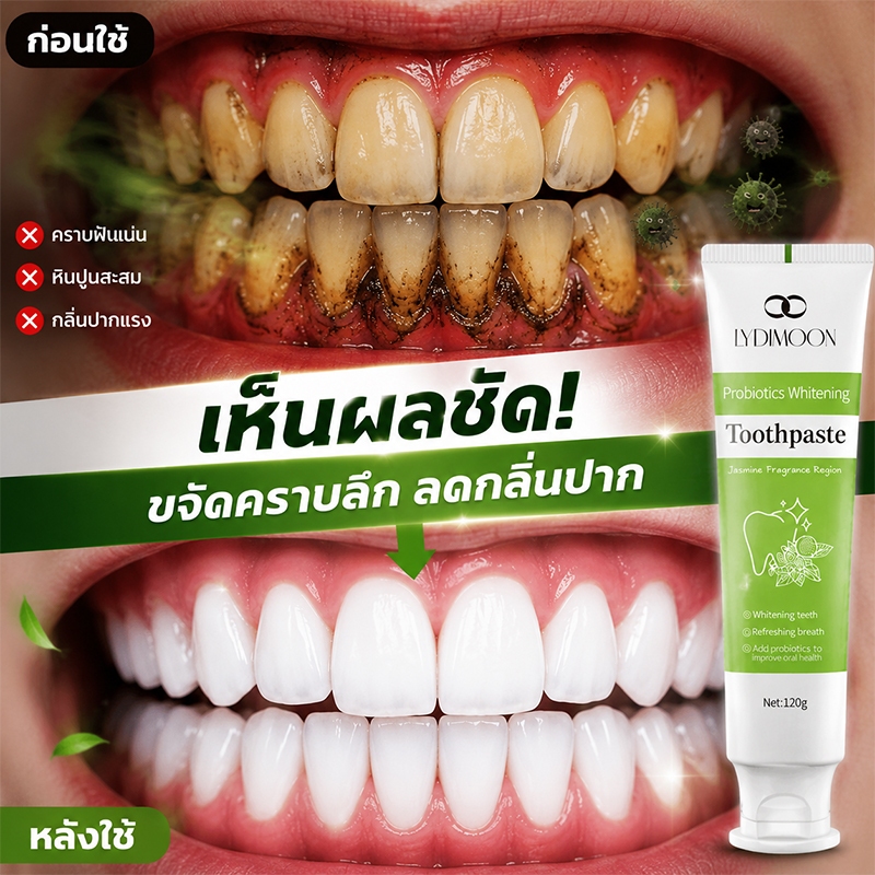 ยาสีฟันโปรไบโอติก ยาสีฟันขาว ยาสีฟันฟอกฟันขาว 120g ฆ่าเชื้อแบคทีเรีย ลดกลิ่นปาก ปกป้องเหงือก ขจัดคราบเหลือง ขจัดคราบหินปูน