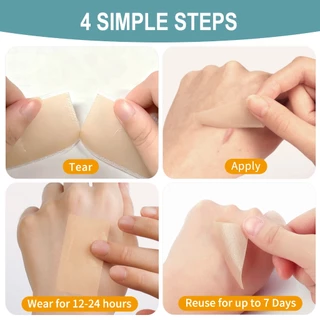 QESTERE Pre-cut Silicone Skin Care Tape ม้วน 4 เมตร (1.6 นิ้ว x 60 นิ้ว) – เทปอ่อนโยนและกันน้ําออกแบบสําหรับผิวแพ้ง่าย