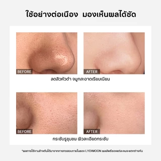มาสก์ดำ ถ่านไผ่ ลอกออก สูตรใหม่ กำจัดสิวหัวดำ สิวเสี้ยน ทำความสะอาดรูขุมขน ลึก ดูดสิ่งสกปรก ฝุ่น ความมัน ผิวสะอาดใส เนียนนุ่ม 60g