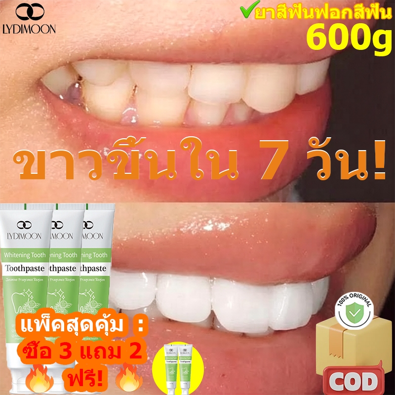 ยาสีฟันโปรไบโอติกยาสีฟันไวท์เทนนิ่งยาสีฟันกลิ่นปาก | ขจัดคราบ ลดคราบหินปูน ดูแลเหงือก ต่อต้านฟันผุ ลมหายใจสดชื่น สําหรับฟันที่บอบบาง ไม่จํากัดเพศ ทุกวัย 120ก