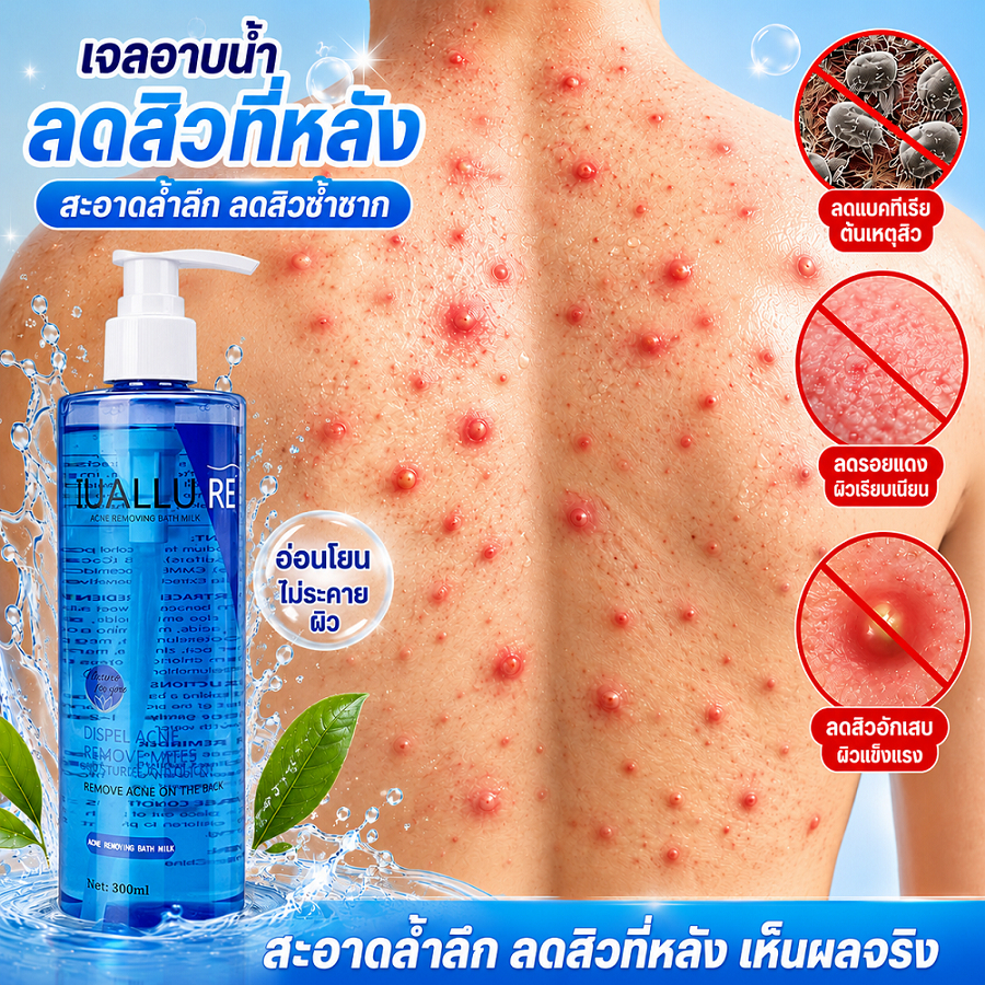 เจลอาบน้ำลดสิว กำจัดไร 300ml ครีมอาบน้ำป้องกันไรฝุ่นกำมะถัน ต่อต้านเชื้อราแก้คัน ลดการสะสมแบคทีเรีย 99.8% ให้ความชุ่มชื้นอ่อนโยน กลิ่นหอมติดทน คุมน้ำมัน ลดสิวที่หลัง