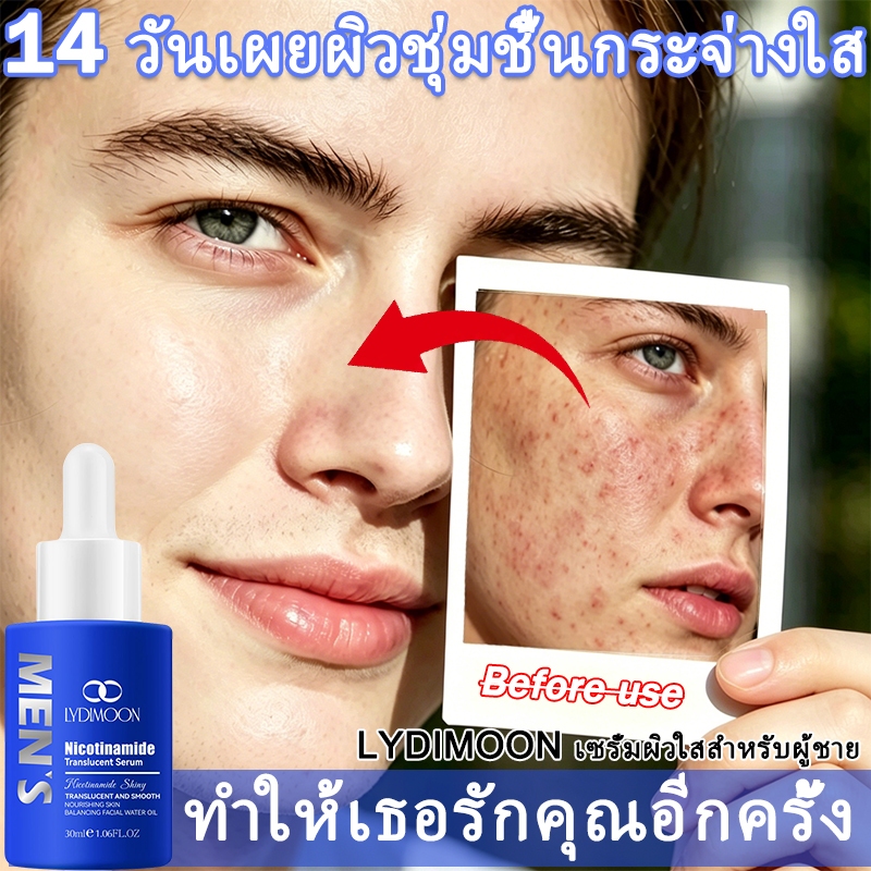 เซรั่มทาหน้าสำหรับผู้ชาย เซรั่มไนอาซินาไมด์ 10% หน้าใส 30ml ปรับปรุงผิวหมองคล้ำ ปรับให้สีผิวกระจ่างใส ยับยั้งเมลามินดำ เติมความชุ่มชื้นอย่างล้ำลึก ลดรอยสิวและจุดด่างดำ ใช้ได้ทั้ง