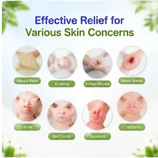 Sudocrem Antiseptic Healing Cream 125g ครีมผื่นผ้าอ้อมเด็กกลากบรรเทา Original UK