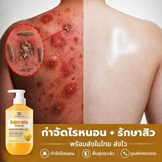 เจลอาบน้ำป้องกันไรฝุ่นกำมะถัน ครีมอาบน้ำกำจัดไร ครีมอาบน้ําลดสิว 500ml กำจัดไรลดสิว แก้คัน ลดการสะสมของแบคทีเรี