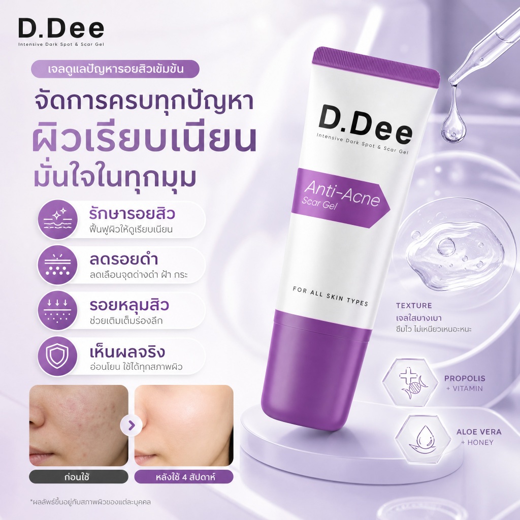 [ของแท้ 100%] [Acne Scar Gel] D.Dee Scar Gel - สําหรับรอยแผลเป็นจากสิว, pockmarks, คีลอยด์ & ทรีทเมนท์จุดด่างดํา, ดร.ดี