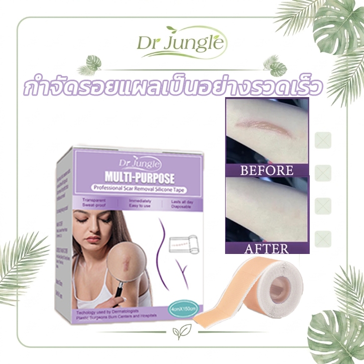 【จัดส่งทัน】DRJUNGLEรักษารอยแผลเป็น กำจัดรอยแผลเป็น แผ่นแปะแผลเป็น 4cm*150cm กําจัดรอยแผลเป็นจากแผลเป็น เผยผิวเนียนสวย