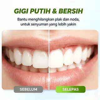 Amway GLISTER Multi-Action Fluoride Toothpasteยาสีฟันแอคชั่นฟลูออไรด์ (200g)