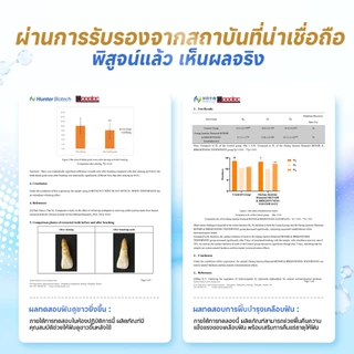 Oartag ยาสีฟันฟันขาว 100g | ฟันขาวกระจ่างใส | ขจัดคราบกาแฟ ชา | ลมหายใจสดชื่น | ดูแลฟันเสียว | ฟื้นฟูเคลือบฟัน