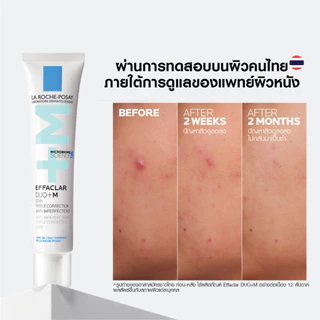 La Roche-Posay Effaclar DUO+M Moisturizer ครีมบํารุงผิวหน้า Acne 40ml