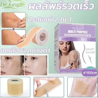 【ของแท้ 100%🔥】Dr.Jungle แผ่นแปะลบแผลเป็น 4*150cmรักษาแผลเป็น ใช้สำหรับลบด่างดำ scar silicone แผ่นแปะลบรอยด่างดำ ออกฤทธิ์เร็วและมีประสิทธิภาพในการกำจัดรอยด่างดำและรอยแผลเป็น