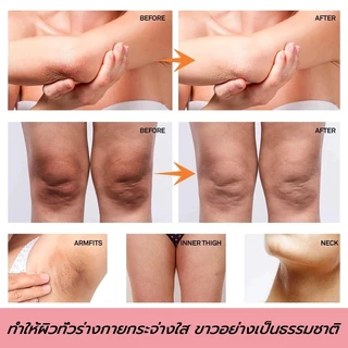 【COD🎉AICHUN ครีมบำรุงผิวสำหรับผู้หญิง ลดเม็ดสีส่วนเกิน บำรุงผิวบริเวณจุดซ่อนเร้นให้กระจ่างใส ปรับสีผิวให้ดูชมพู อ่อนโยน ไม่ระคายเคือง