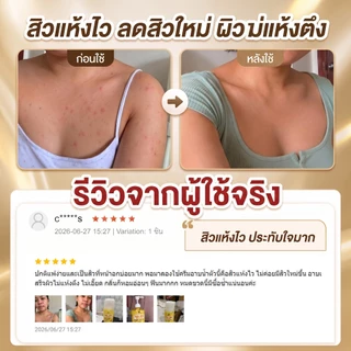 เจลอาบน้ำป้องกันไรฝุ่นกำมะถัน ครีมอาบน้ำกำจัดไร ครีมอาบน้ําลดสิว 500ml กำจัดไรลดสิว แก้คัน ลดการสะสมของแบคทีเรี