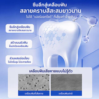 OSUN M2 Smart Cold Light Teeth Whitening Device Teeth Whitening White Teeth Reduce Yellow Stains Safe Authentic Guarantee